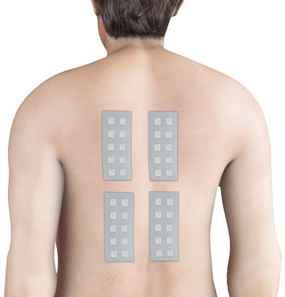 Patch Testing